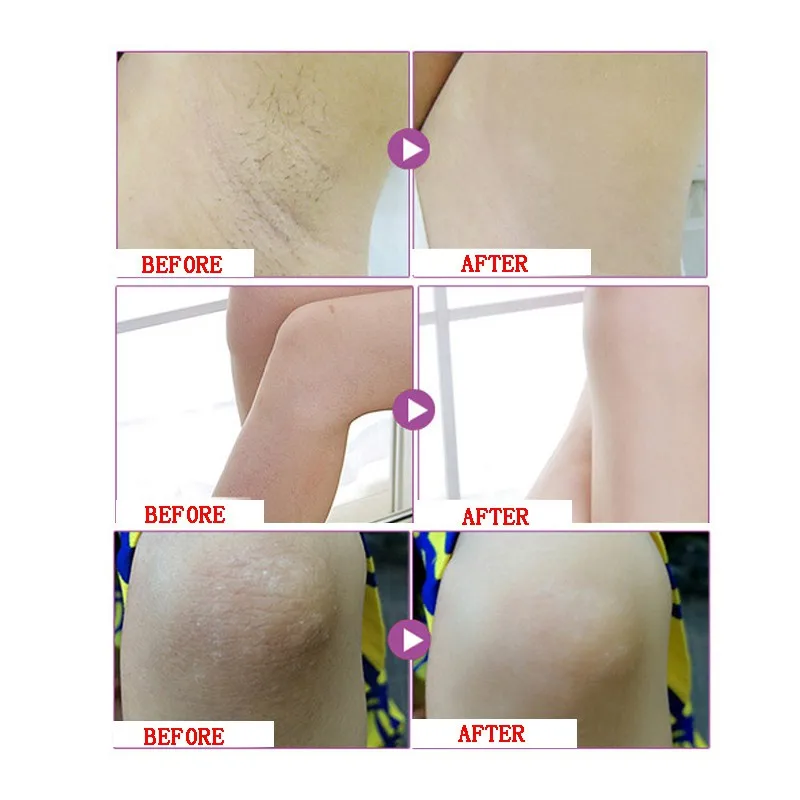 50g Beauty Armpit Whitening Cream Body Underarm Cream Whitening Cream Legs and Knees Private Parts Skin Whitening Skin Care 50g Beauty Armpit Whitening Cream Body Underarm Cream Whitening Cream Legs and Knees Private Parts Skin Whitening Skin Care