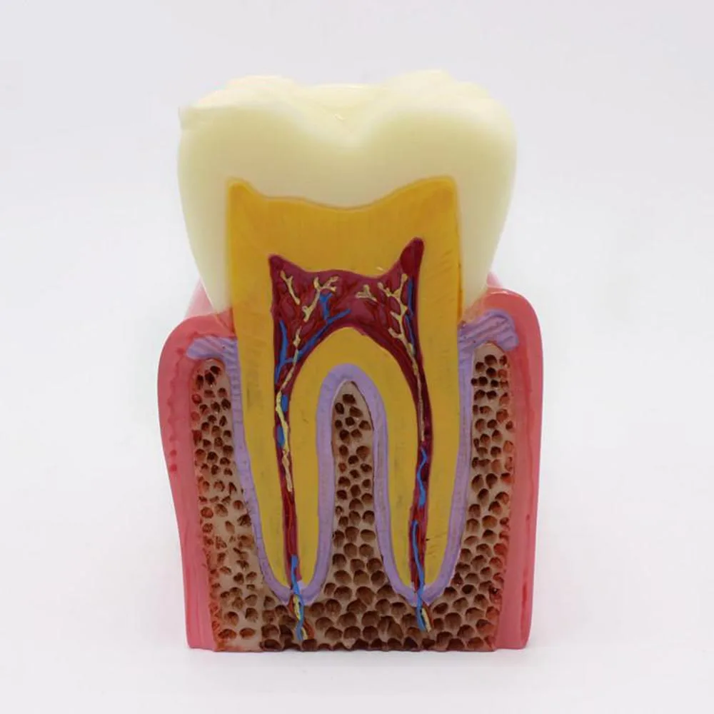 6X Zoom Caries Tooth Model Dentist Patient Communication