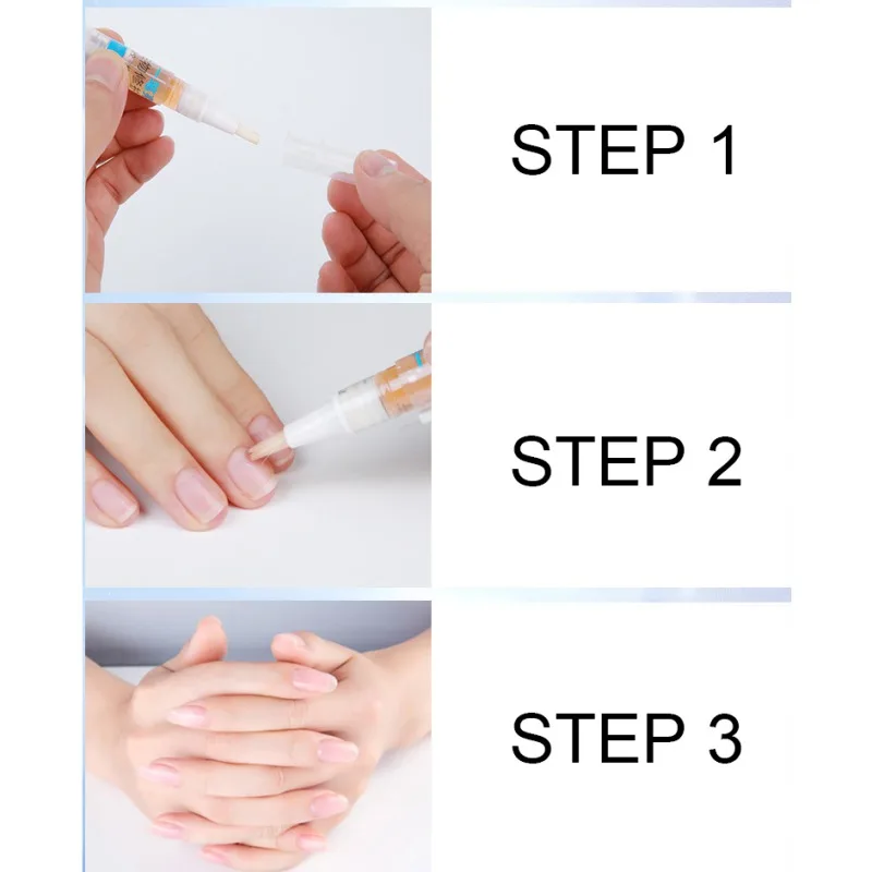 нафтифин мизол эвалар. лечение ногтей волжский фуст.