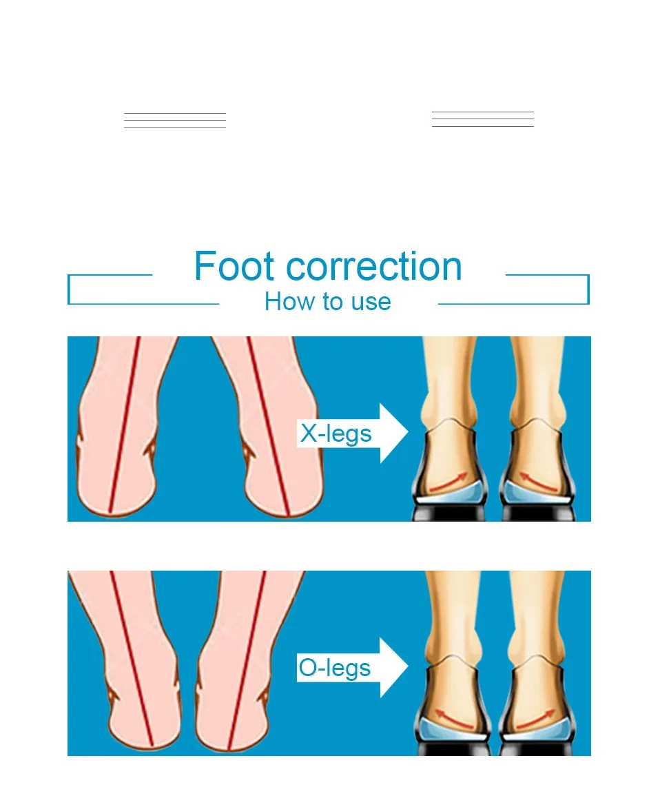 Soumit гель O/X тип ноги ортопедические стельки внутри снаружи ноги коррекции ортопедические пятки поддержка Вставки колодки для мужчин женщин