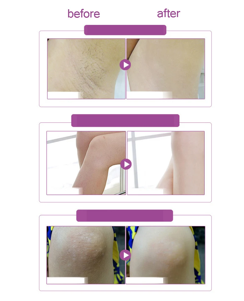 Aichun интимный крем для отбеливания тела отбеливающий крем для подмышек ног и коленей личные части отбеливающий крем уход за кожей
