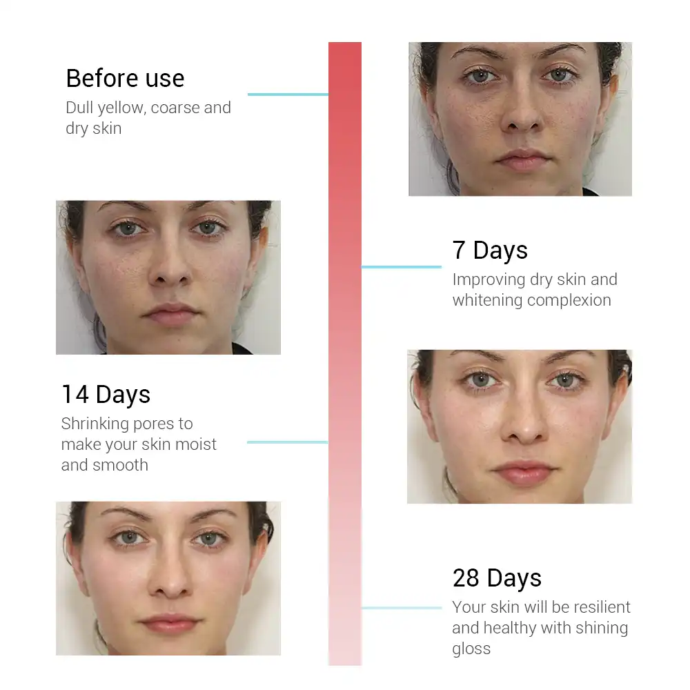 retinol for dry skin