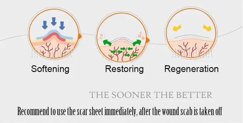 Медицинский силиконовый гель шрам от листа терапевтическая рана; шрам патч удаляемая чесаная область раздел гипертрофическая Sca келиоидная повторная обработка