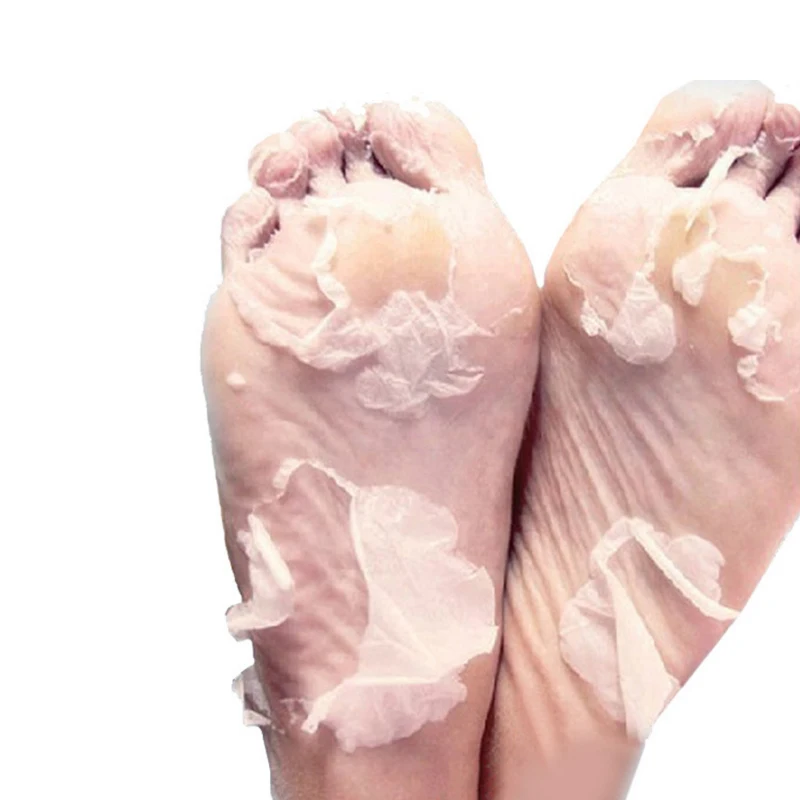2pcs=1bag Baby Foot Peeling Renewal Exfoliating Mask For Feet Remove Dead Skin Cuticles Heel Care Pedicure Socks | Красота и здоровье