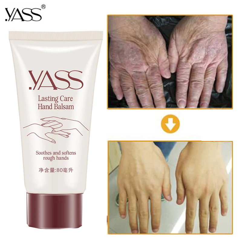 YASS Plant Glycerin Hand Creams Whitening Moisturizing Rose Hand Lotions Nourishing Anti-Aging Hand Feet Care Cream for Unisex