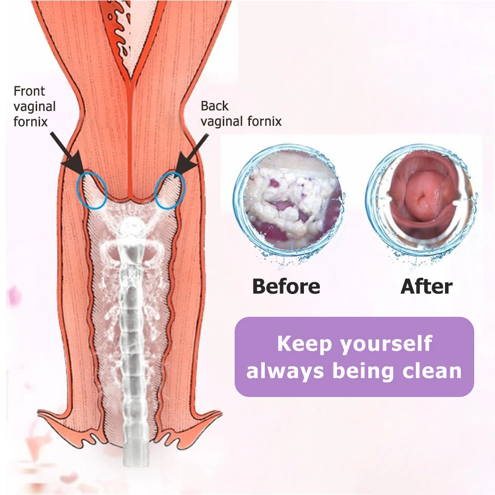 Здоровый вагинальный клирнер анальный клизмы инструмент многоразовый медицинский ирригатор для влагалища попа анус Очищающая спринцовка для женщин, вагинальный мойщик
