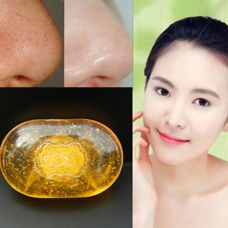Natural Active handmade soap skin whitening soap blackhead remover acne treatment face Whitening