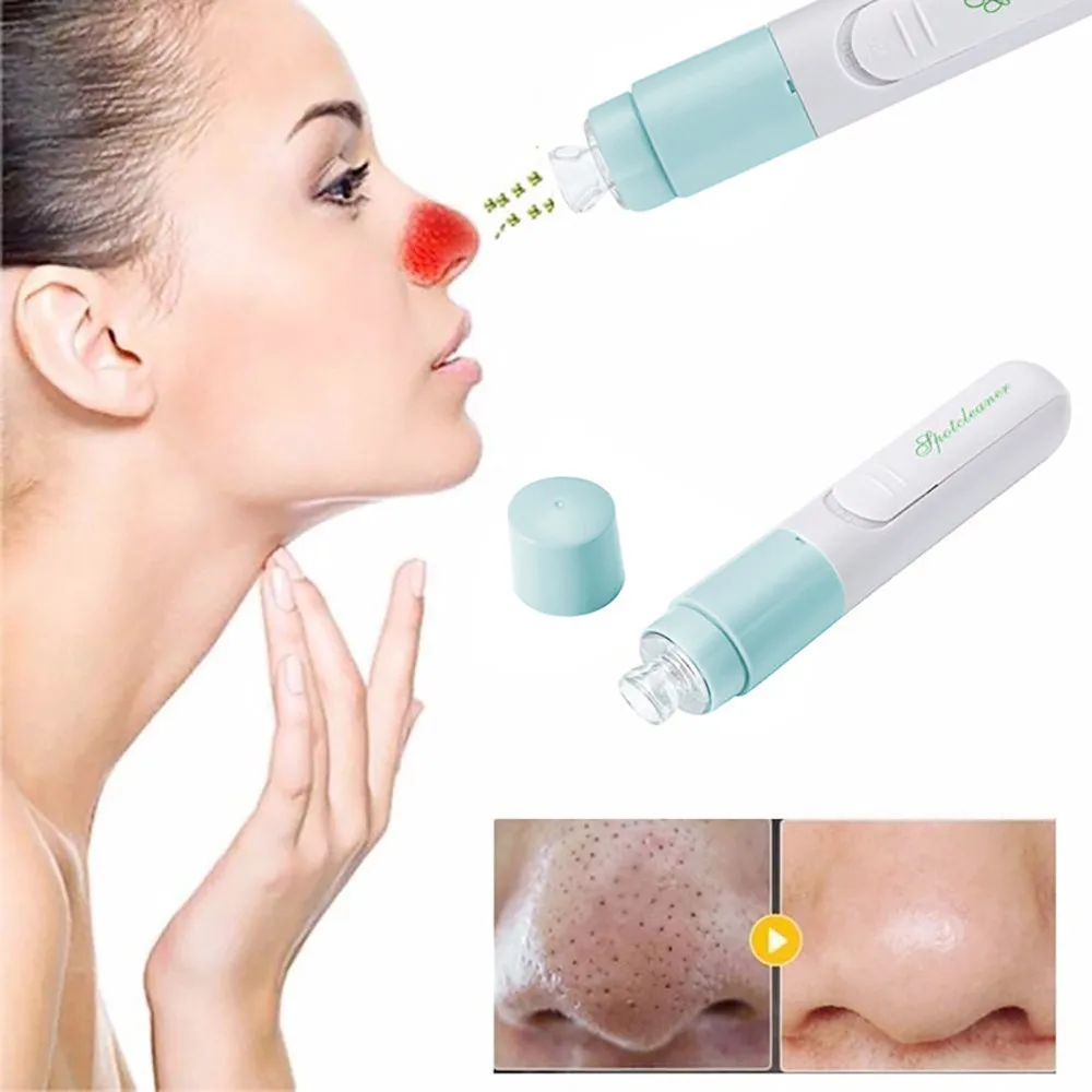 Women Cleaner Vacuum Suction Facia Remover Electric Skin Facial