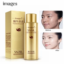 Улиточный дозатор, Тоник для лица, гиалуроновая кислота, увлажняющий, отбеливание, лечение акне, против старения, против морщин, уход за кожей, макияж, вода 120 мл