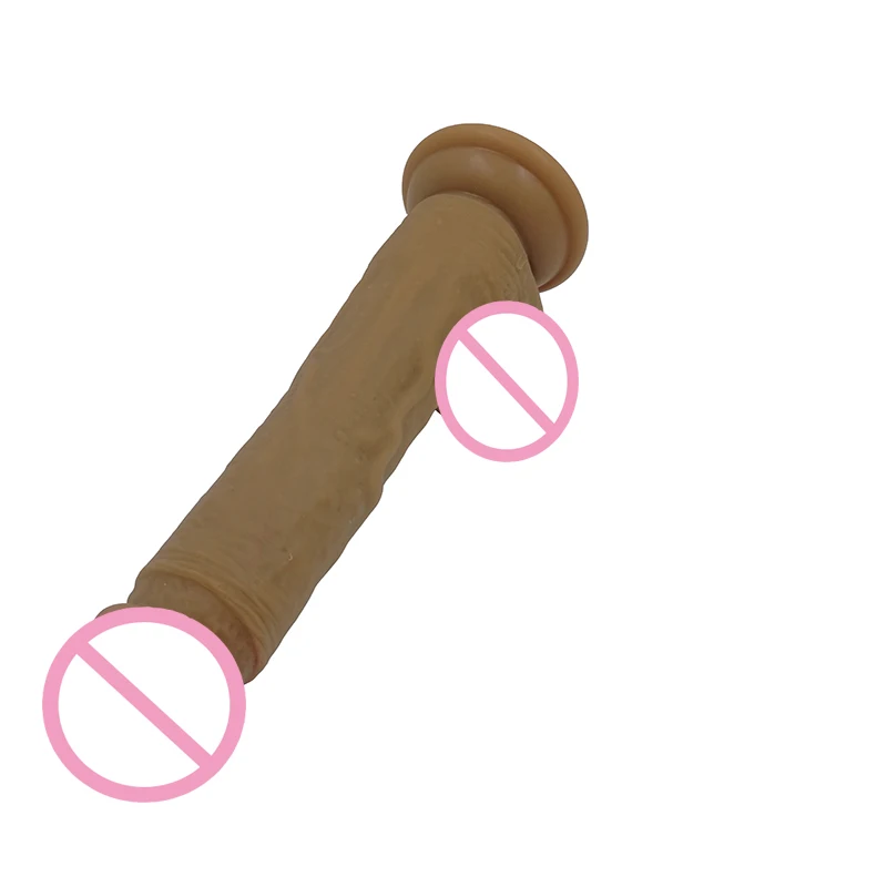 867