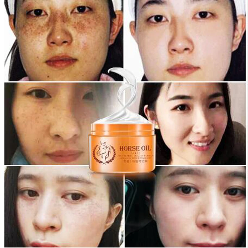 LAIKOU Horse Oil Cream Anti Aging Cream Scar Face Body Whitening Cream Ageless Korean Cosmetic Skin Care Whitening Moisturizing