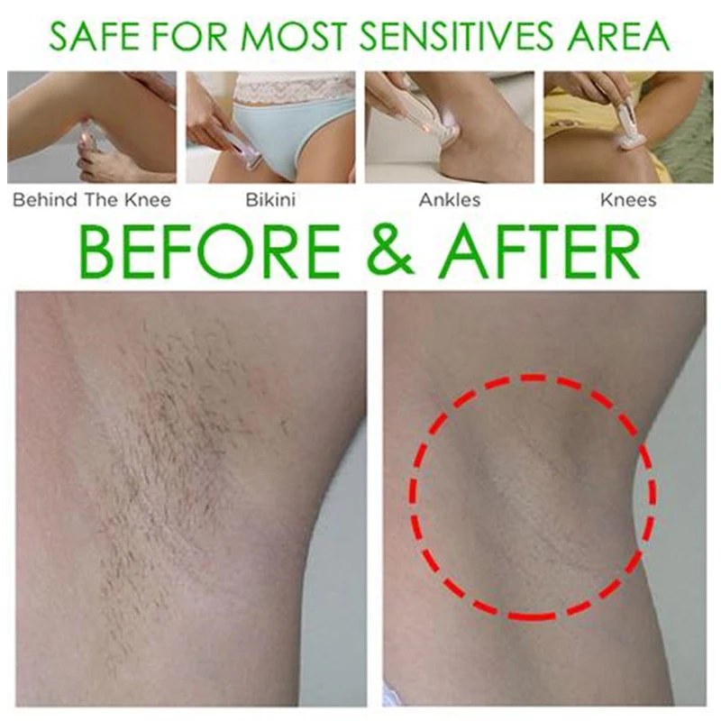 bikini trimmer before after