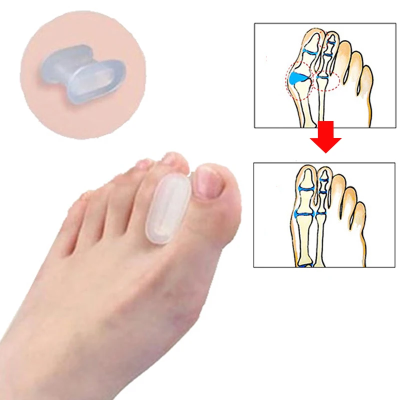 

3 Pair Bunion Corrector Silicone Toe Separators Stretchers Alignment Hallux Valgus Correction Pedicure Tool Toe Spacer Feet Care