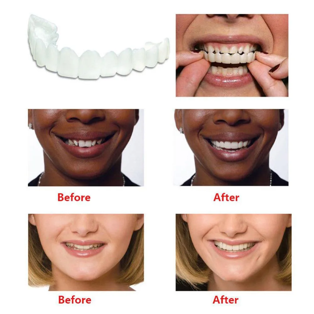 Teeth Whitening Teeth Cover Fits Most Comfortable Denture Care False Dental Teeth Veneers 4
