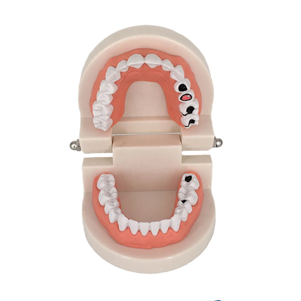 Распавшие зубы модель для детей стандартная прозрачная демонстрационная Стоматологическая модель зубов Модель зубного протеза модель зуба для студентов