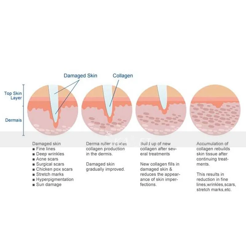6 в 1 дермароллер микронидлинг наборы для многократного ухода за кожей омоложения лечение иглы микродермабразия роллор