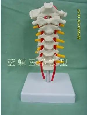 Model of cervical vertebra with carotid artery, occipital bone, intervertebral disc and nerve teaching, cervical vertebra model Model of cervical vertebra with carotid artery, occipital bone, intervertebral disc and nerve teaching, cervical vertebra model
