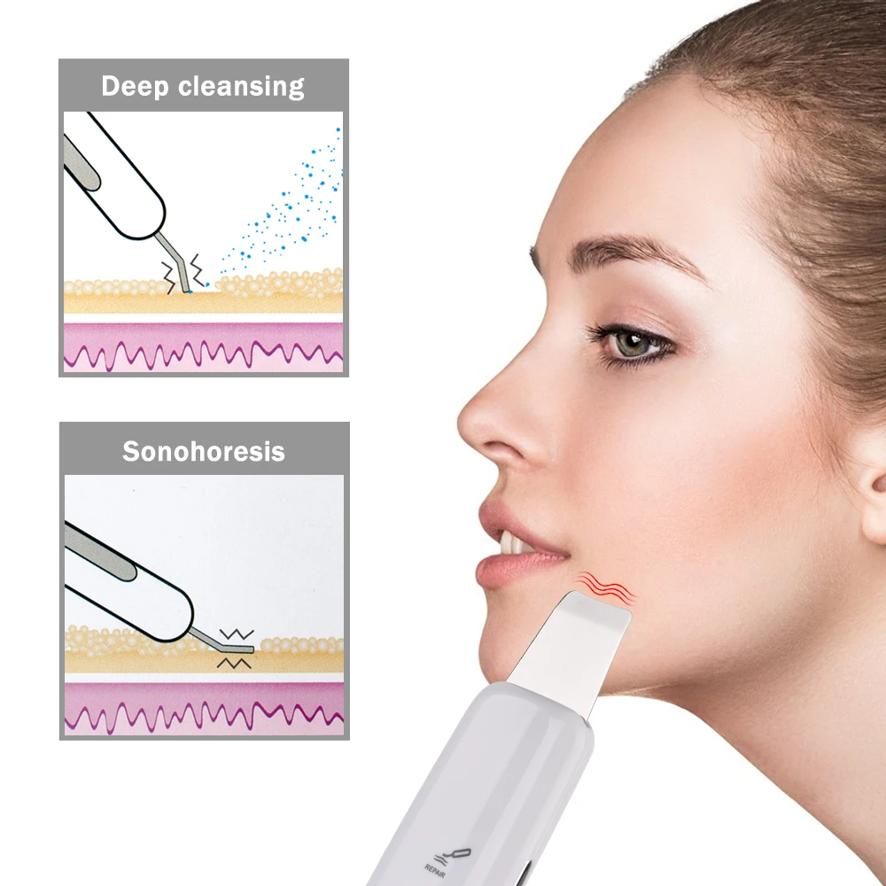 High Frequency Skin Scrubber Ultrasonic Ion Rechargeable Microdermabrasion Deep Cleaning Vibration Face Peeling Facial Massager 4