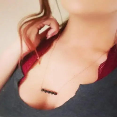 XL0176