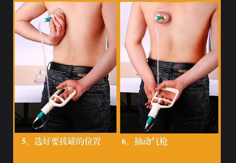 24 чашки танки китайский медицинские вакуумные присоски комплекты Магнитная hijama терапия тела Расслабляющий массажер для Здравоохранение