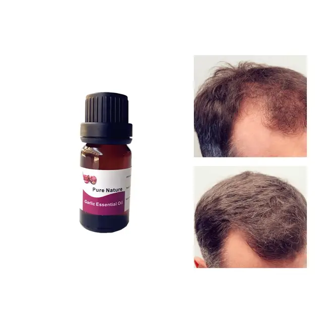 Garlic Oil Hair Care Treatment Essential Oil Fast Powerful Hair