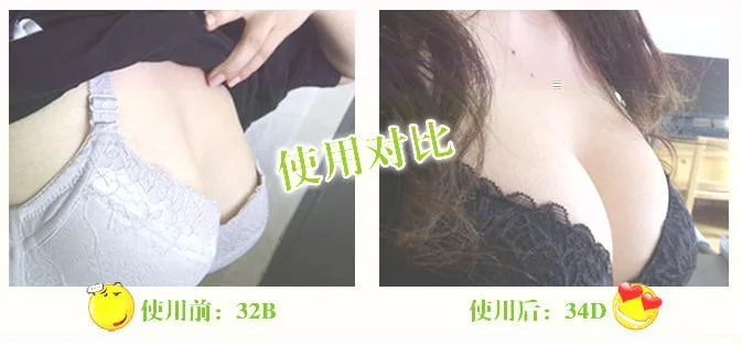 snap394