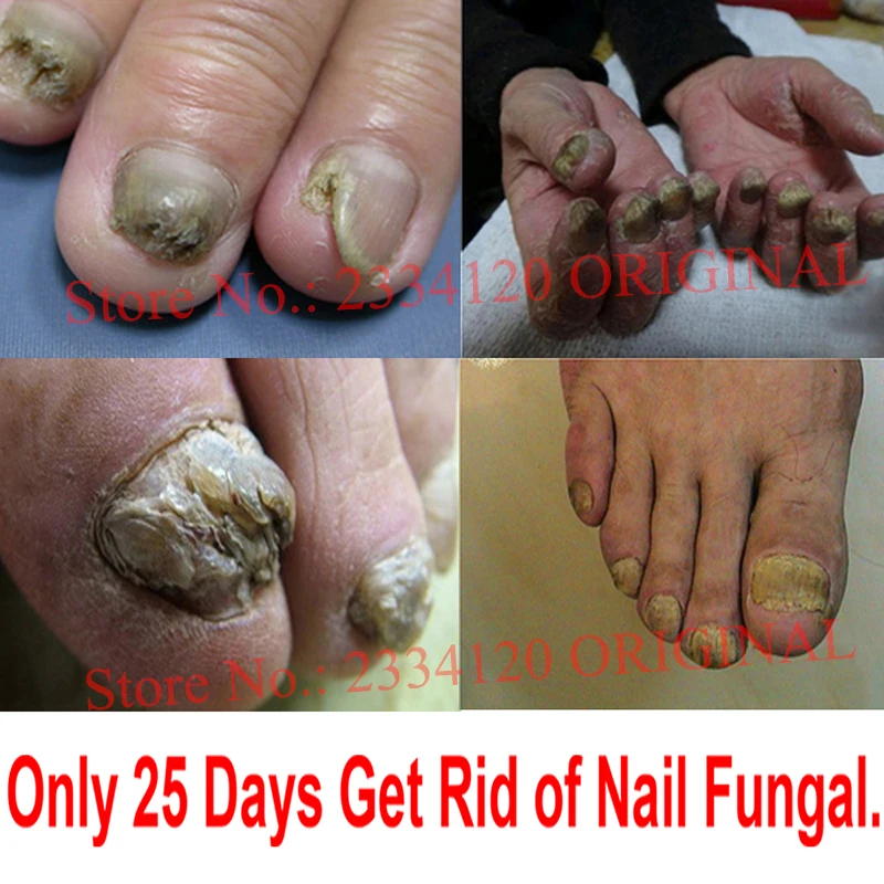 Nail-001-M