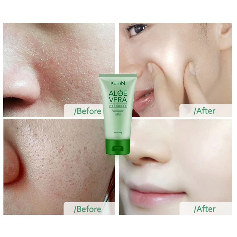 “ Creme de Beleza Calmante Aloe Vera Gel Diluir
