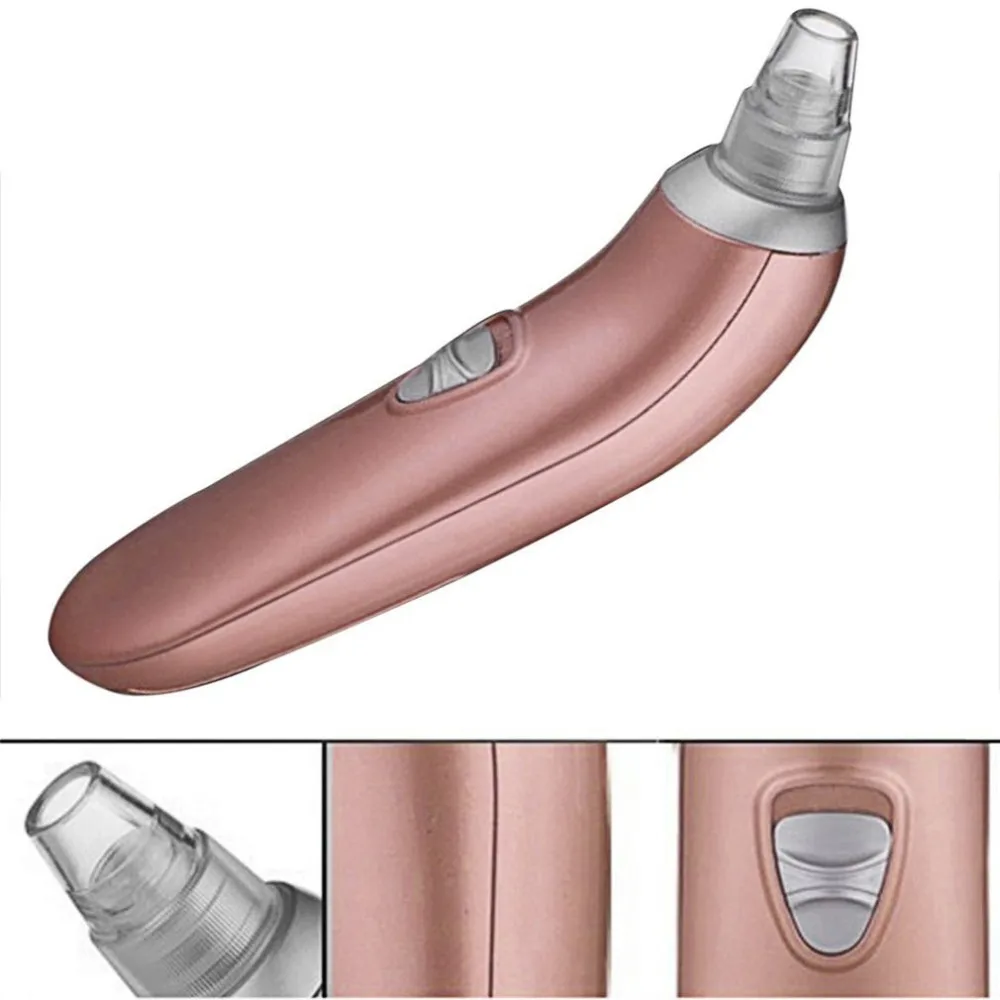 Инструмент для удаления угрей, 1 шт., электрический прибор для ухода за кожей лица, очиститель пор и угрей, вакуумный очиститель акне, инструменты для ухода за лицом