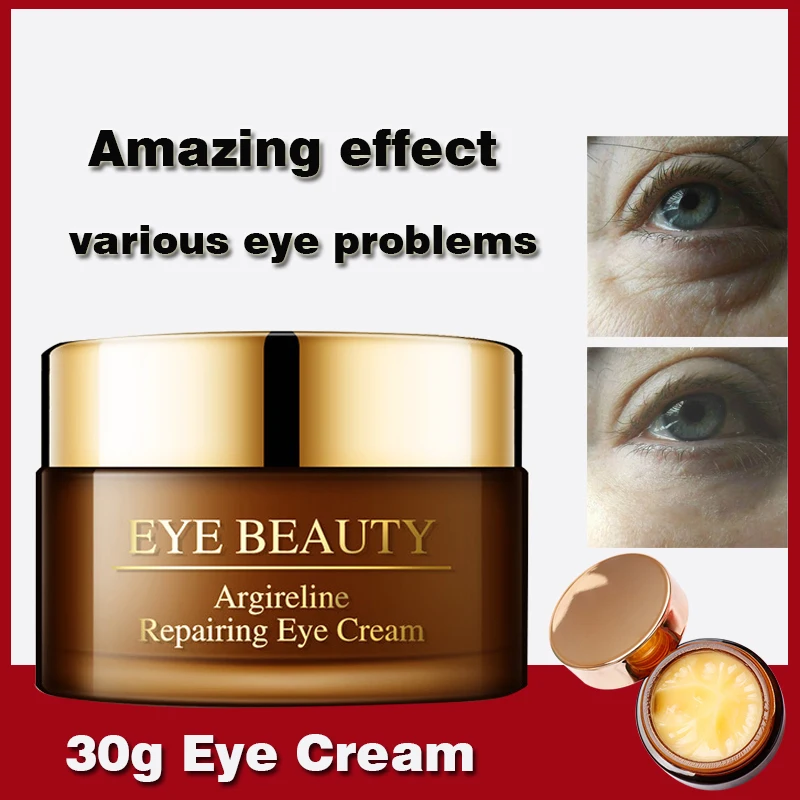 Remove Dark Circles Eye Cream Treatment Eye Bag Moisturizing Firming