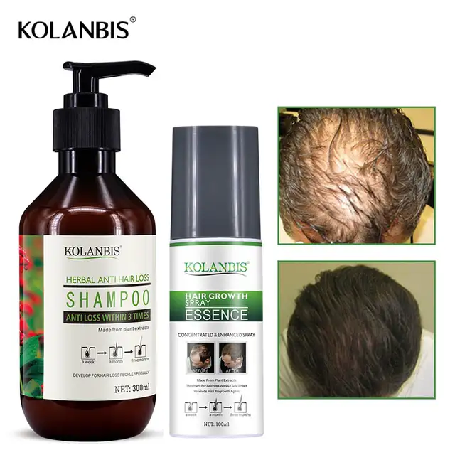 2 Bottles Men Anti Hair Loss Shampoo And Herbal Growth Tonic