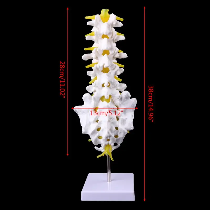 

Anatomical Lumbar Vertebrae Model Caudal Vertebra Anatomy Medical Teaching Tool