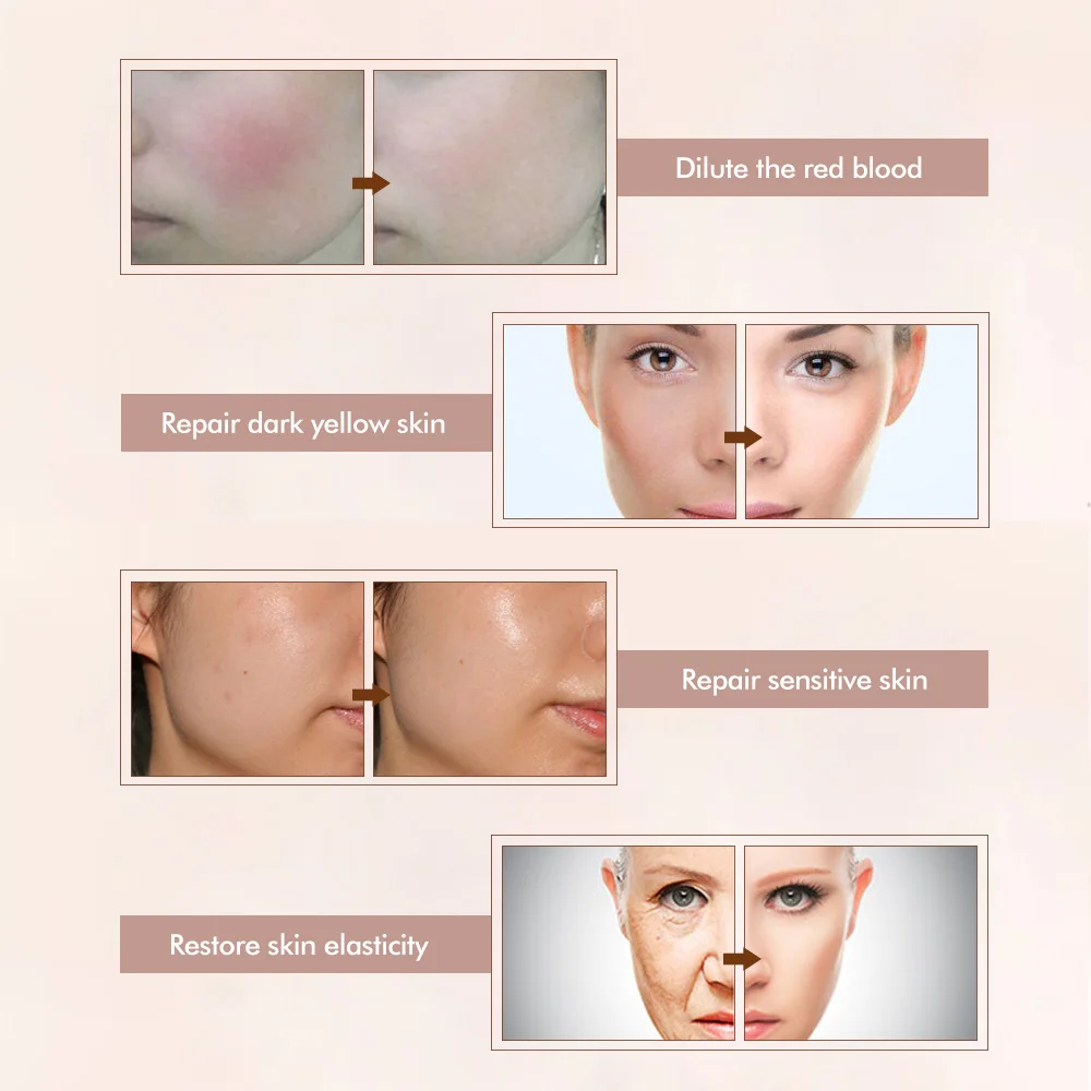 Ameizii Snail Face Whitening Moisturizing Serum Facial Anti-aging Serum Brighten Skin Care Hyaluronic Acid Pore Firming Essence