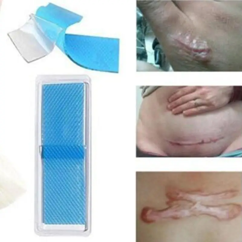 

1PCS Self-Adhesive Waterproof Scar Repair Paste Silicone Medical Patch Skin Gel Scar Therapy Patch Support Wholesale & Drop ship
