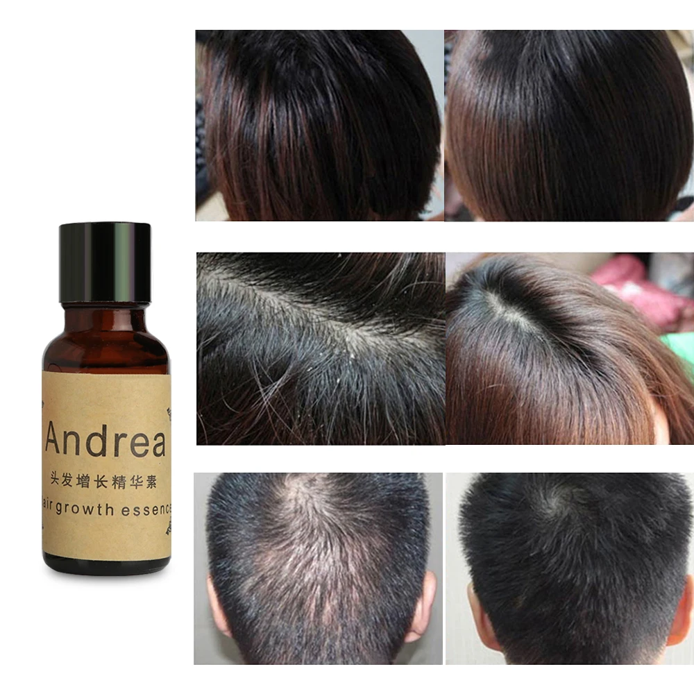 Как пользоваться essence. Andrea hair growth Essence. Сыворотка Андреа для роста волос. Сыворотка hyoing hair growth Essence. Средство для роста волос на голове.