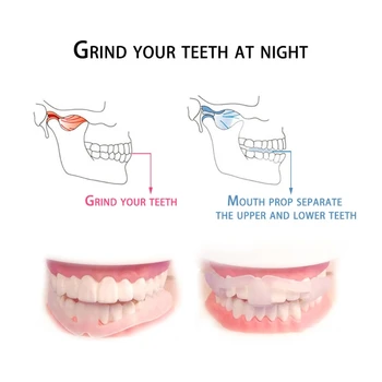 

1pc POE Anti Grinding Teeth Protector Dental Mouth Guard Grinding Bruxism Gum Shield