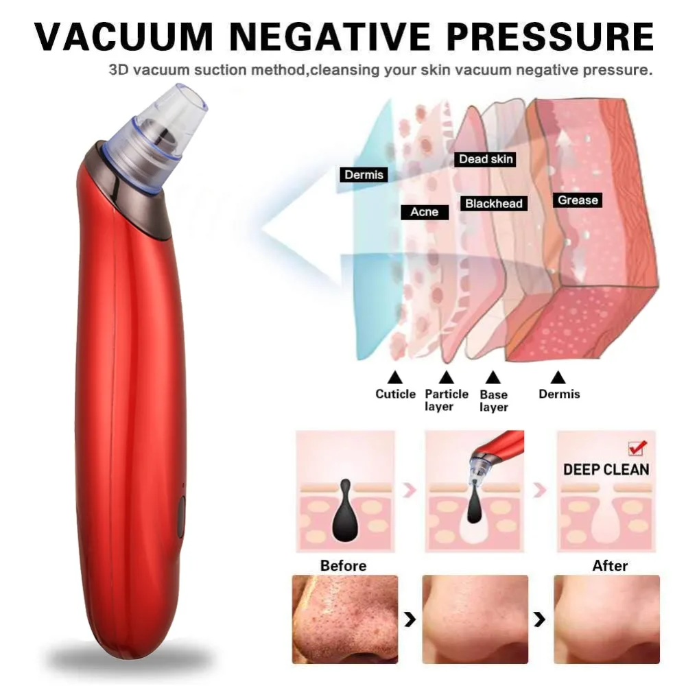 Вакуумные Электрический Очиститель пор акне угрей удаления извлечения USB перезаряжаемые Comedo угольная маска для носа красота Tool Kit