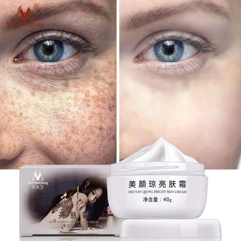 

Meiyanqiong Anti Aging Face Care Cream Dark Spot Remover Skin Lightening Cream Dark Skin Care Anti Freckle Whitening Cream New