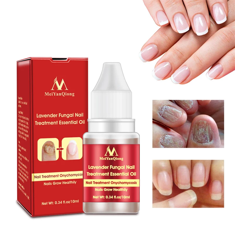 

Lavender Fungal Nail Treatment Essential Oil Nail Fungus Removal Infection Feet Care Polish Gel Herbal Moist Essential oil 10ml