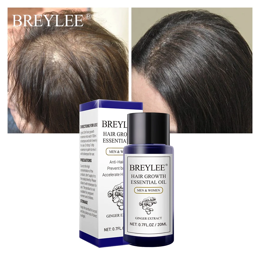 Breylee Hair Growth Essential Oil 20ml Fast Powerful Hair Products