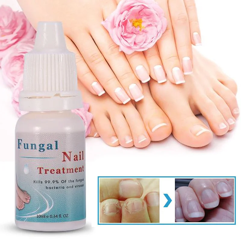 

10ml Fungal Nail Treatment Essence Nail Foot Whitening Toe Fungus Removal Feet Care Nail Gel for Onychomycosis TSLM2