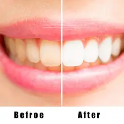 Зубы отбеливающая жидкость гигиена полости рта для чистки уход за зубами чистящая жидкость QRD88
