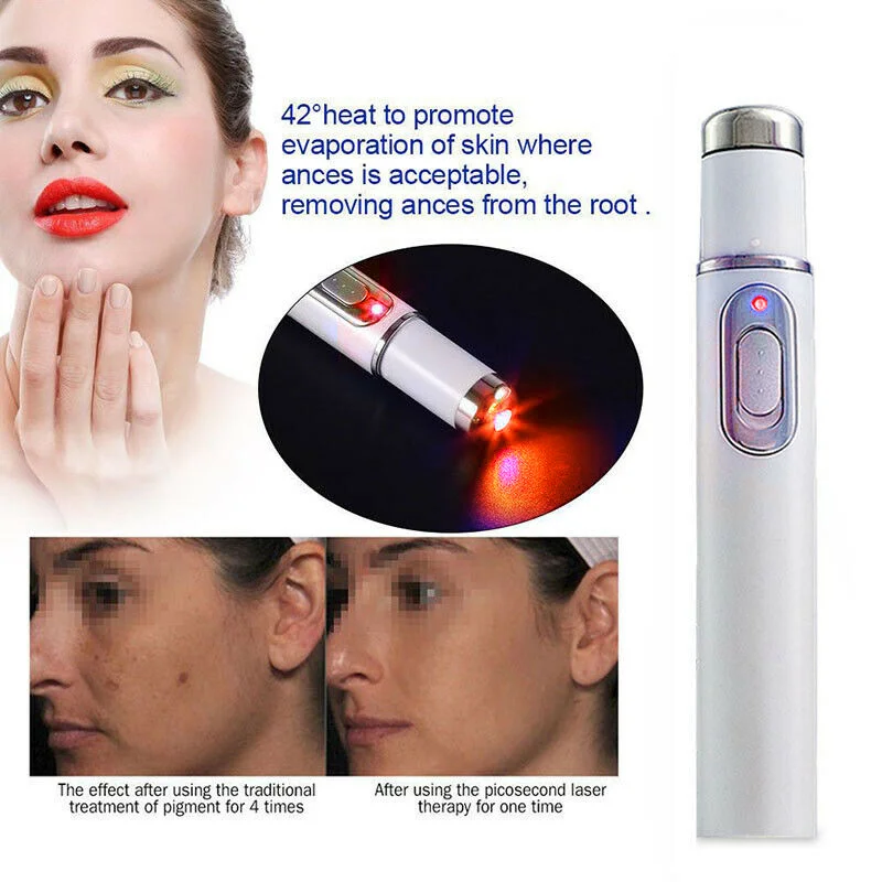 

1pc Skin Care Soft Scar Wrinkle Removal Remove Blackhead Acne Medical Red Light Therapy Laser Treatment Pen Treatment Device