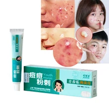 Face Whitening Moisturizing Acne Ointment Antibacterial Acne Treatment Cream For Acne Scar Removal psoriasis cream D167 Face Whitening Moisturizing Acne Ointment Antibacterial Acne Treatment Cream For Acne Scar Removal psoriasis cream D167