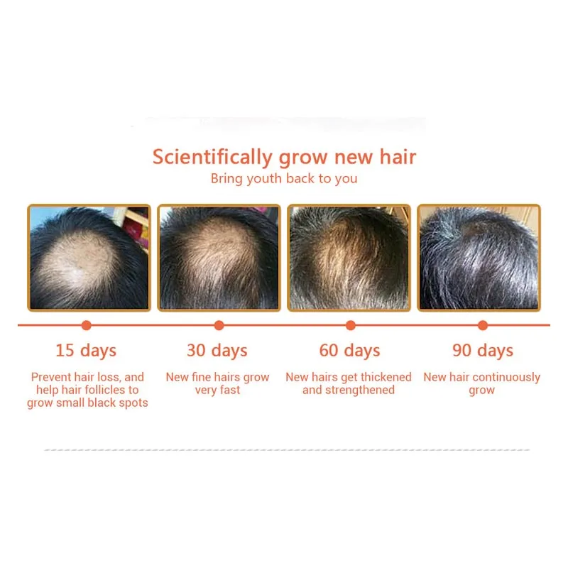 Sevich уход роста волос, эфирные Масла сущность оригинальной аутентичной от выпадения волос жидких продуктов здравоохранения красивые, густые