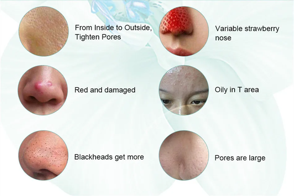 Removedor de Cravo Controle de Óleo Diminuir os Poros Natural Acne Rosto Soro Ácido Hialurônico Vitaminas Essência Hidratante Branqueamento 2 Pcs 11 Beleza e saúde