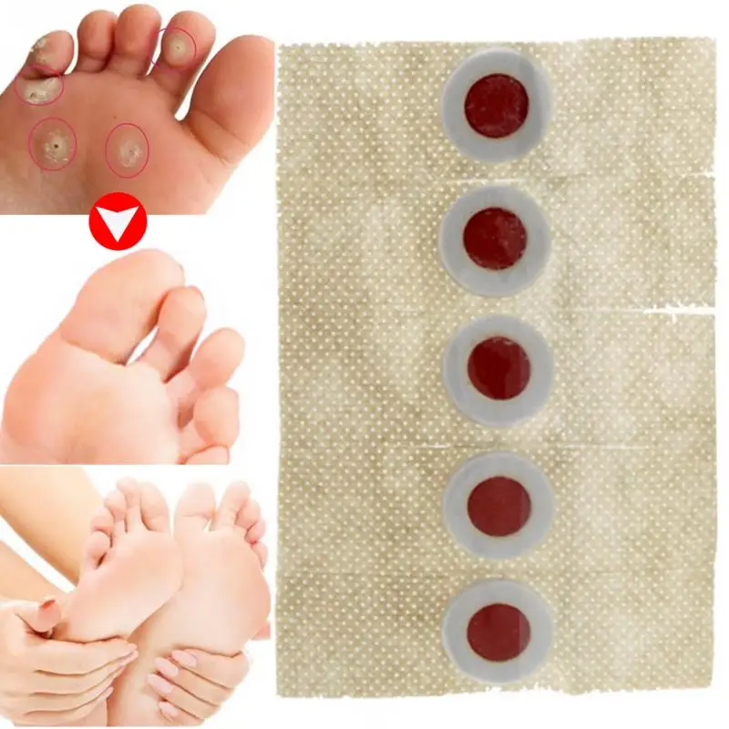 

40Pcs/Box Feet Care Corn Removal Warts Thorn Plaster Soften Medical Painless Feet Patch Skin Corn Plaster