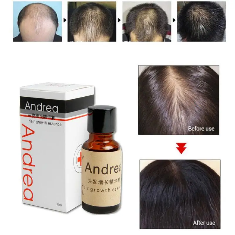 XY Fancy 20 мл натуральное быстрое средство для роста волос масло Сыворотка от выпадения волос масло