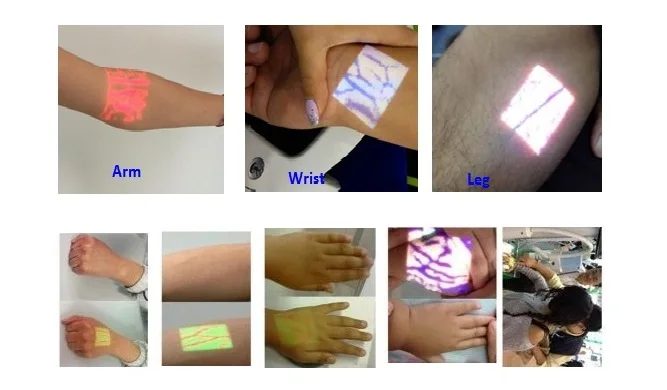 Vein show pic 1