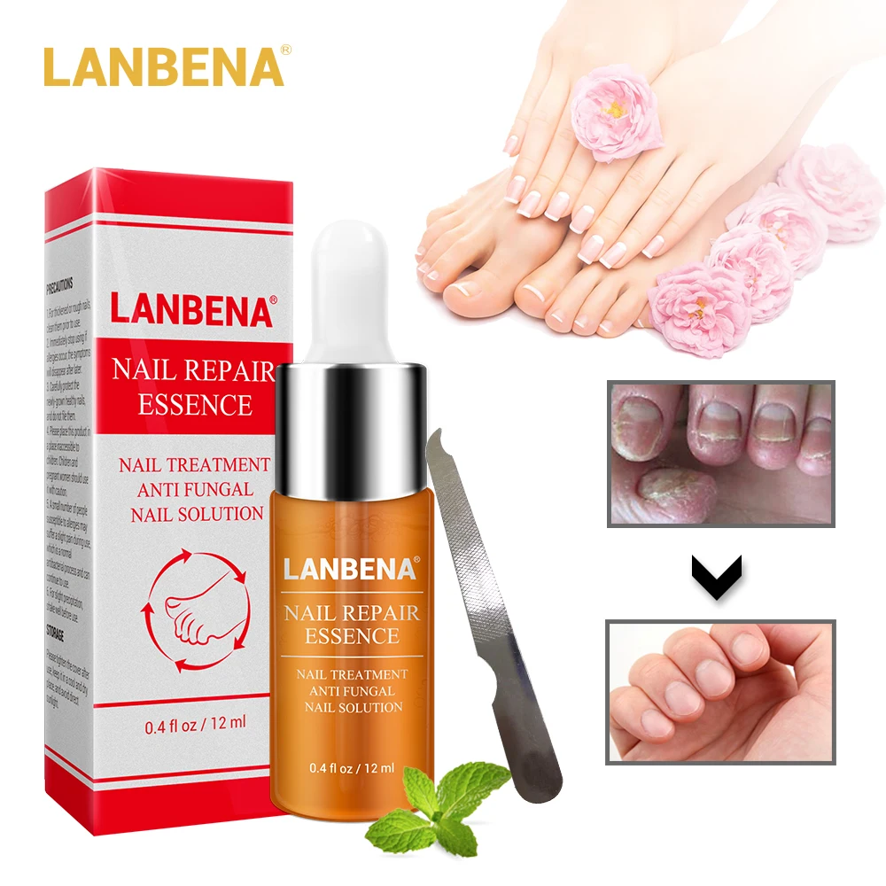 LANBENA Nail Repair Essence-Serum Fungal Nail Treatment Remove Onychomycosis Nose Tooth Nutrient Lightening Hand and Foot Care